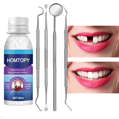 Temporary tooth repair kit - tooth,