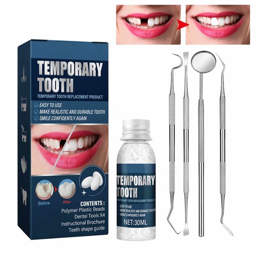 Tooth repair kit moldable - repair,
